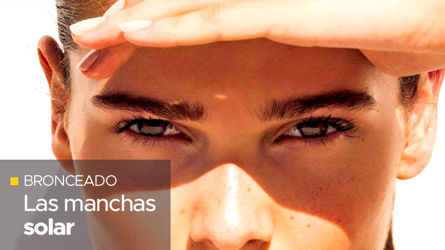 manchas solares